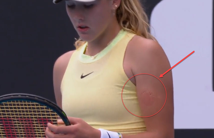 WEIRD. Mirra Andreeva bites herself during Australian Open match