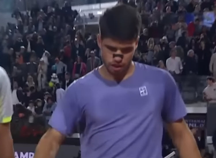 Carlos Alcaraz reflects on recent struggles after Rome victory Alcaraz With Injury And Cold